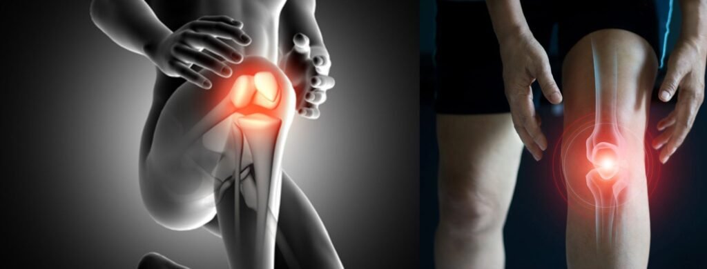 Best knee and hip replacement center Hyderabad