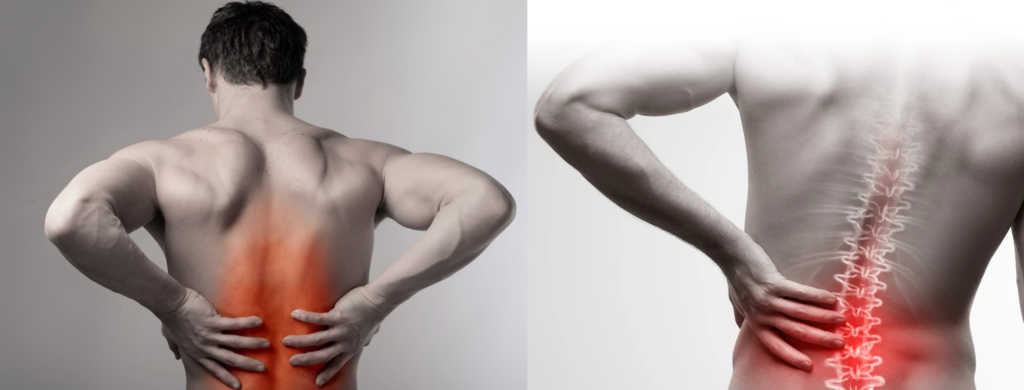 Non-surgical back pain treatment Hyderabad