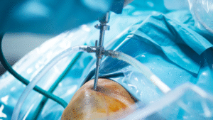 Best Arthroscopic Surgeons in Hyderabad