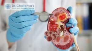 Best Center for Kidney Stones Management – Dr. Chaitanya’s Pain & Multi Speciality Hospital